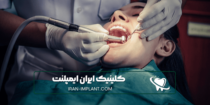 انواع بیهوشی برای ایمپلنت دندان