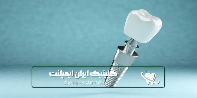 مزایای ایمپلنت دندان با بیهوشی کامل چیست