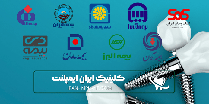 پرداخت هزینه ایمپلنت دندان با بیمه