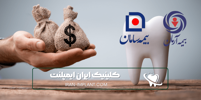 بهترین بیمه تکمیلی برای ایمپلنت دندان