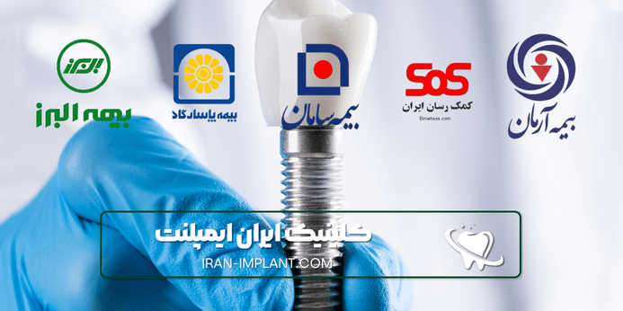 پوشش بیمه ها برای ایمپلنت