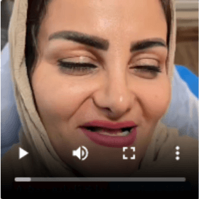 عکس ویدئو