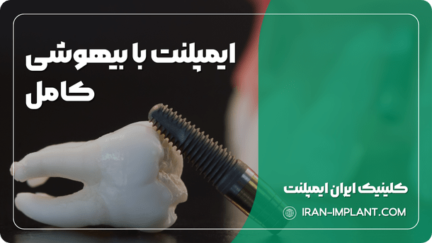 ایمپلنت با بیهوشی کامل