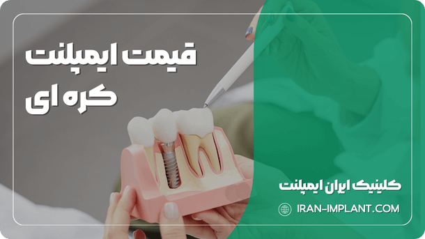 قیمت ایمپلنت کره ای