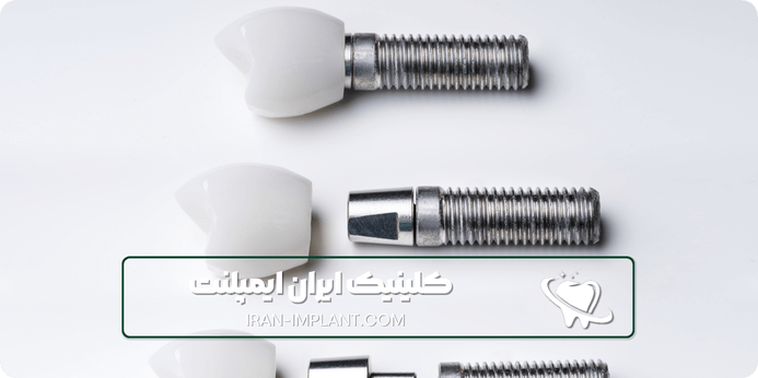 مزایای ایمپلنت کره ای