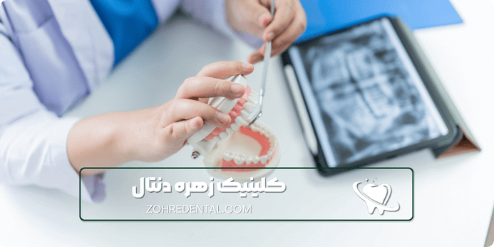 انواع بیهوشی برای ایمپلنت دندان