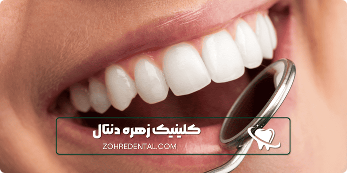 مراحل ایمپلنت دندان با بیهوشی
