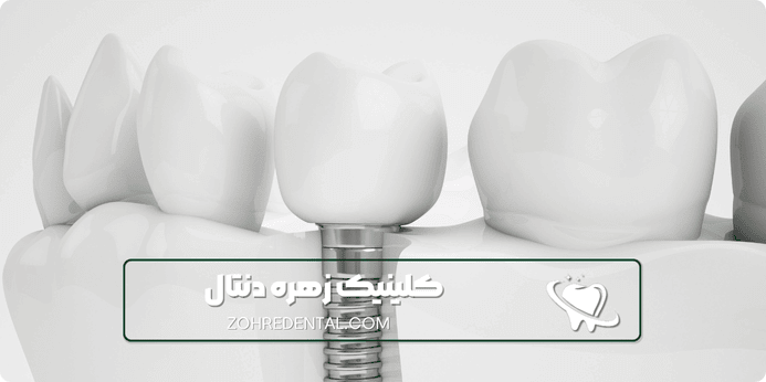 نکات طلایی برای انتخاب بیمه مناسب دندانپزشکی