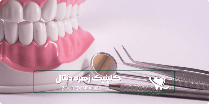 انواع خدمات دندانپزشکی شبانه روزی
