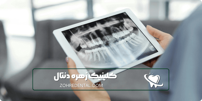 مزایای دندانپزشکی شبانه روزی چیست