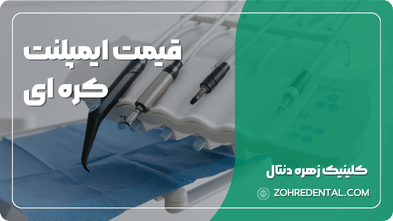 قیمت ایمپلنت کره ای
