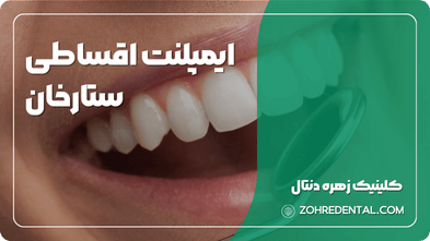 ایمپلنت اقساطی ستارخان