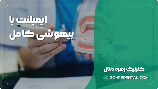 ایمپلنت با بیهوشی کامل