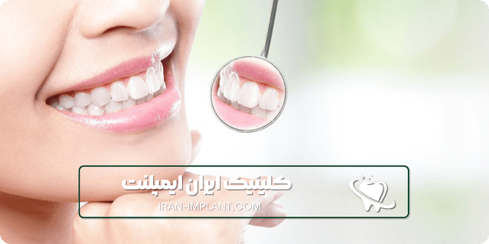 مزایای مراجعه به کلینیک دندانپزشکی ستارخان به جای مطب