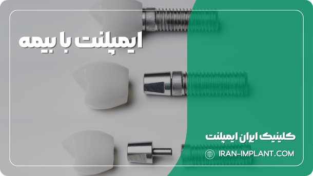 ایمپلنت با بیمه