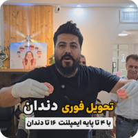 ایمپلنت بدون لقی