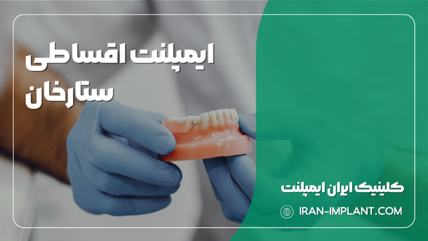 ایمپلنت اقساطی ستارخان