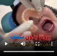 کاور ویدیو 1