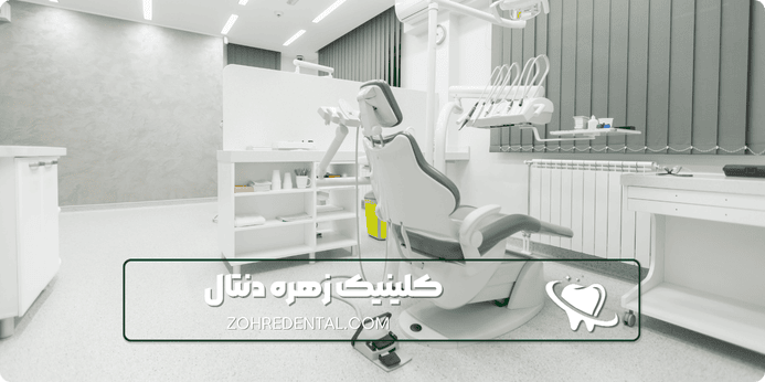 عوامل موثر بر قیمت ایمپلنت اقساطی تهران