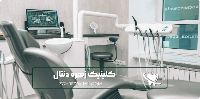 مزایای ایمپلنت اقساطی