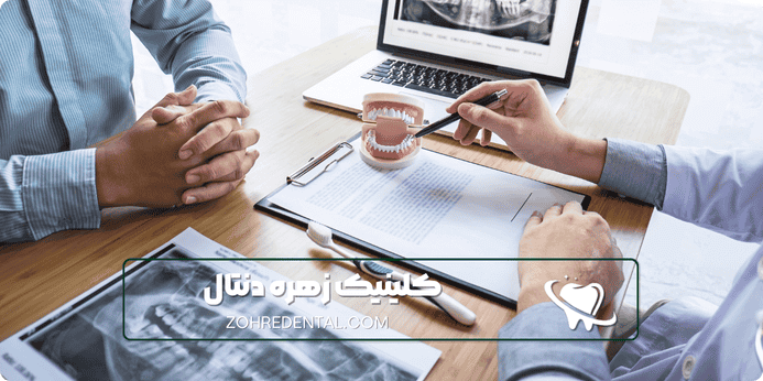 نکاتی که باید قبل از انجام ایمپلنت اقساطی بدانید