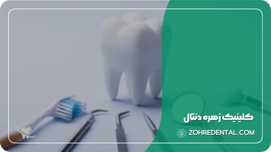 هزینه ایمپلنت با بیمه تکمیلی البرز
