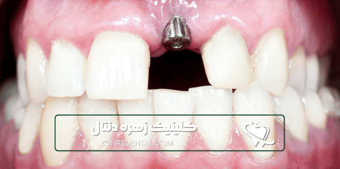 مدارک مورد نیاز برای بیمه آسیا