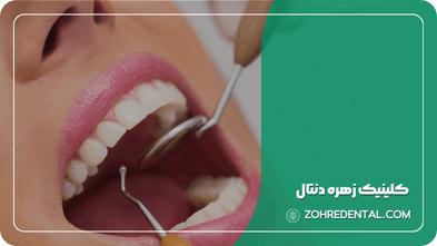 بهترین دندانپزشکی در غرب تهران