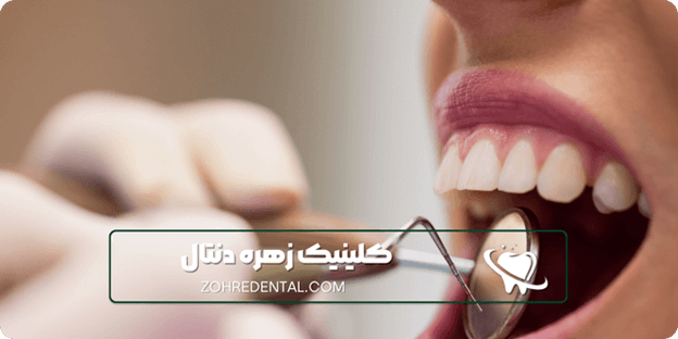 بهترین دندانپزشکی در غرب تهران کدامند معرفی 5 کلینیک برتر